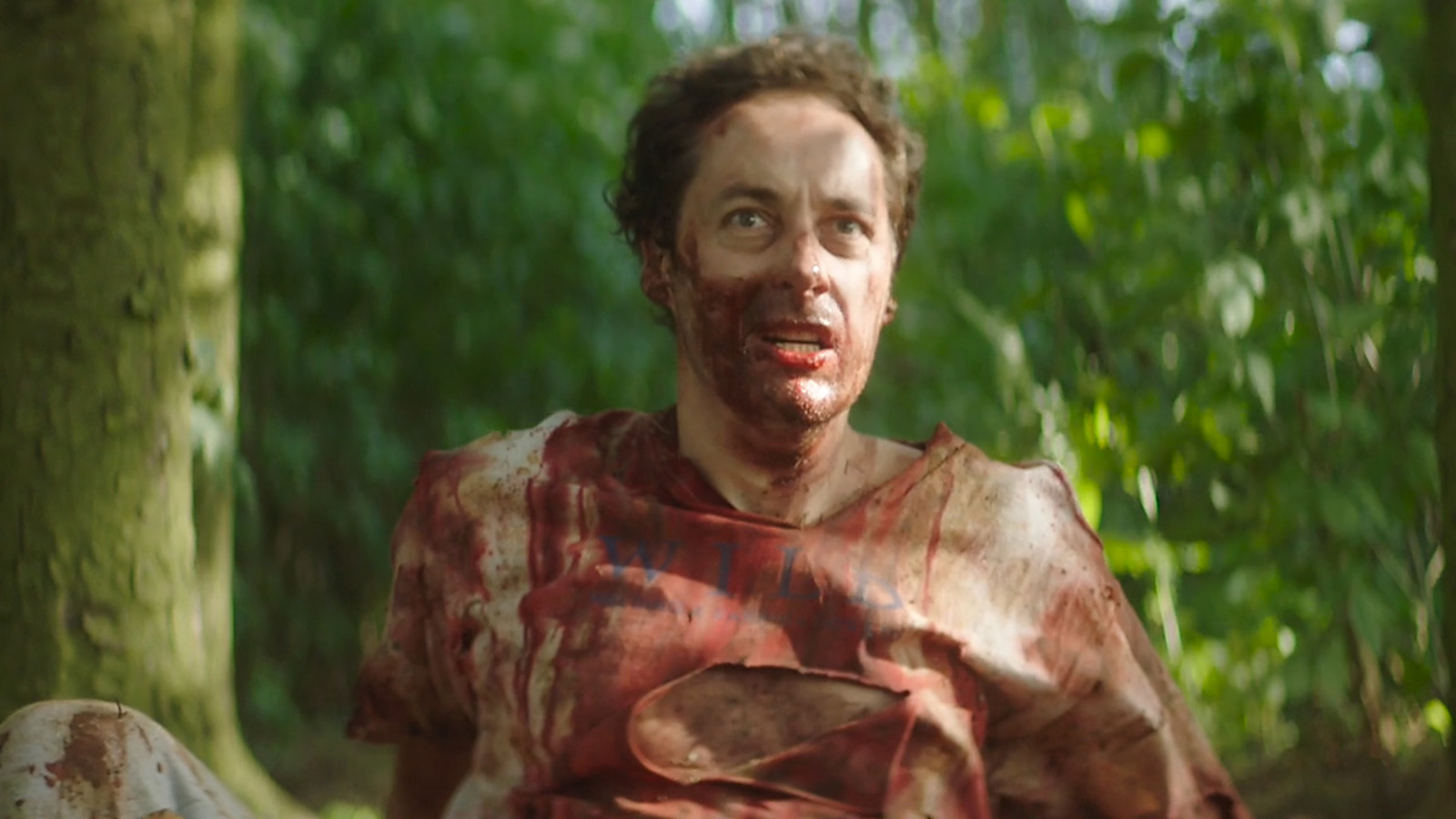 Graham sits in a forest, bloodied and confused, in a scene from THE WILDS